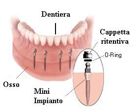 Mini IMPIANTI