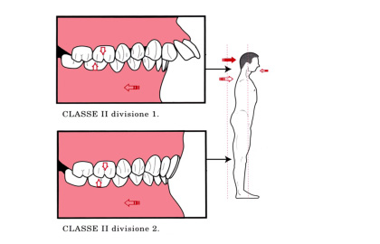 odontoiatria-classe2